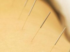 上海徐浦中醫醫院：針灸的作用是什么？原理是什么？
